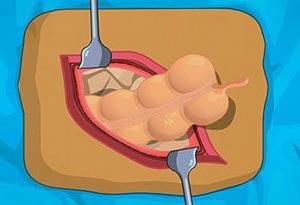Medical Operation: Health Puzzle